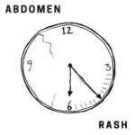 Review: Abdomen - Rash